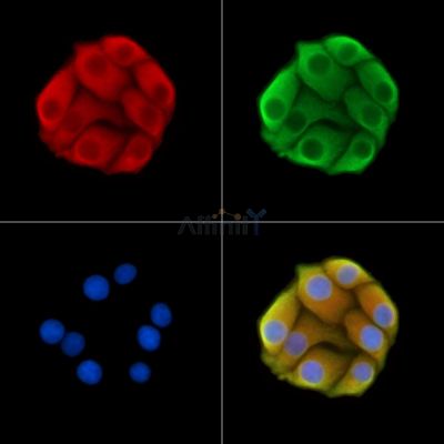FKBP8 Antibody - DF14506 staining Hela cells by IF/ICC.