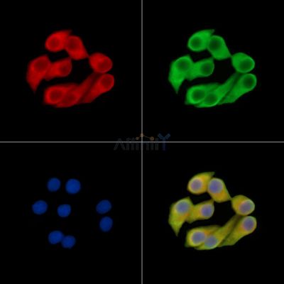 TGM3 Antibody - DF14512 staining Hela cells by IF/ICC.