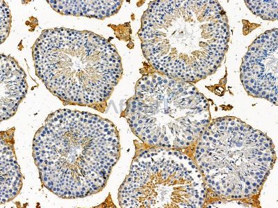 TGM3 Antibody - DF14512 at 1/100 staining mouse testis tissue by IHC-P.