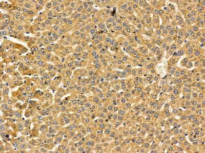 TGM3 Antibody - DF14512 at 1/100 staining rat liver tissue by IHC-P.
