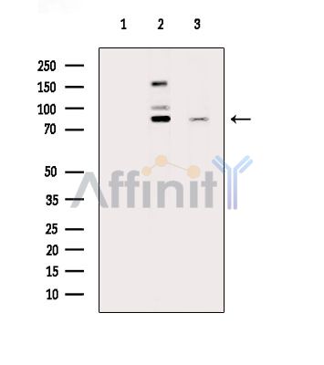 DDX1 Antibody - Western blot analysis of extracts from various samples, using DDX1 Antibody.