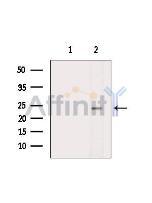 UBE2E1 Antibody - Western blot analysis of extracts from HepG2 cells(heat-shock treatment), using UBE2E1 Antibody.