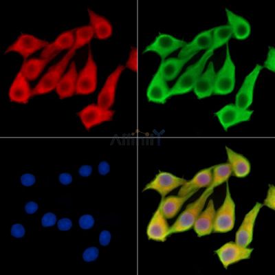 DKKL1 Antibody - DF14553 staining Hela cells by IF/ICC.