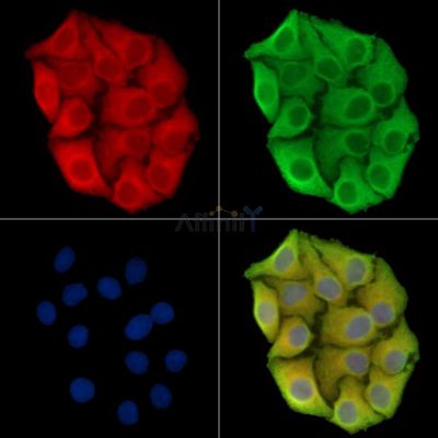 MGAT1 Antibody - DF14556 staining Hela cells by IF/ICC.