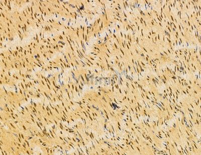 DDX39B Antibody - DF14568 at 1/100 staining rat stomach tissue by IHC-P.