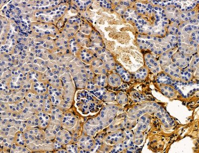 CACNB2 Antibody - DF14574 at 1/100 staining mouse kidney tissue by IHC-P.