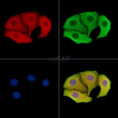 CPEB2 Antibody - DF14583 staining Hela cells by IF/ICC.