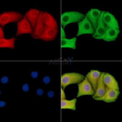 SLC13A3 Antibody - DF14589 staining Hela cells by IF/ICC.