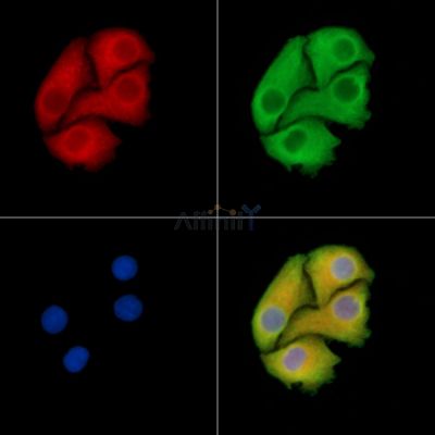 SEPSECS Antibody - DF14590 staining Hela cells by IF/ICC.