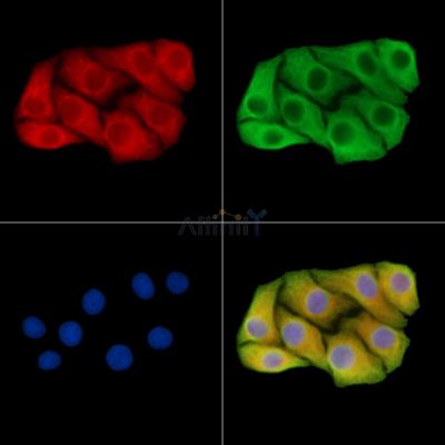 TRPM3 Antibody - DF14592 staining Hela cells by IF/ICC.