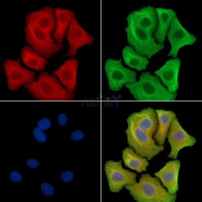 CUEDC1 Antibody - DF14596 staining Hela cells by IF/ICC.