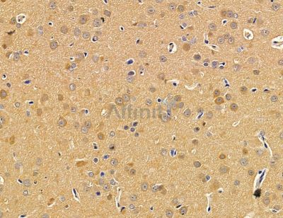 CUEDC1 Antibody - DF14596 at 1/100 staining rat brain tissue by IHC-P.