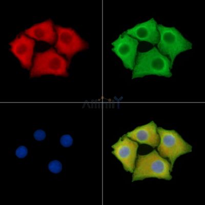 SLC25A45 Antibody - DF14599 staining Hela cells by IF/ICC.