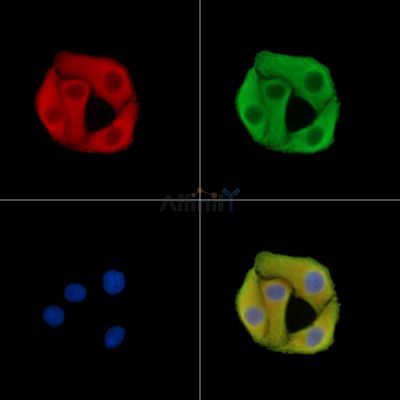 SLC25A29 Antibody - DF14603 staining Hela cells by IF/ICC.