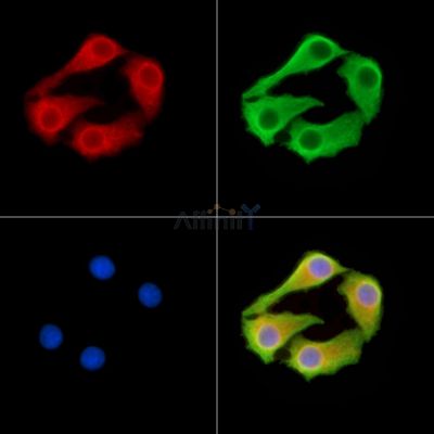 IGSF1 Antibody - DF14619 staining Hela cells by IF/ICC.