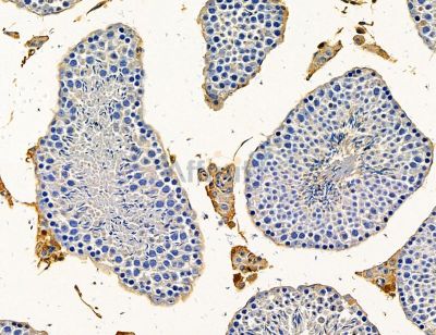 LGI2 Antibody - DF14622 at 1/100 staining mouse testis tissue by IHC-P.