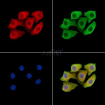 SLITRK5 Antibody - DF14623 staining Hela cells by IF/ICC.