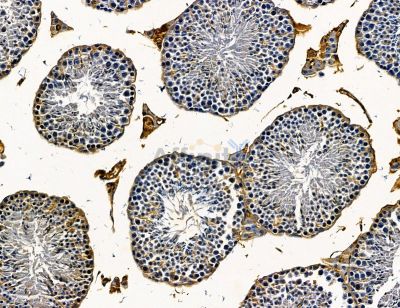 SLITRK6 Antibody - DF14624 at 1/100 staining mouse testis tissue by IHC-P.