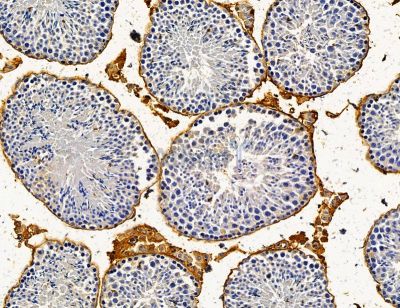 TMC6 Antibody - DF14625 at 1/100 staining mouse testis tissue by IHC-P.