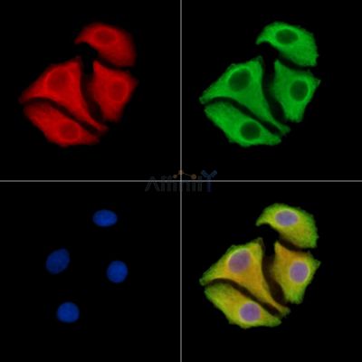 TMC6 Antibody - DF14625 staining Hela cells by IF/ICC.