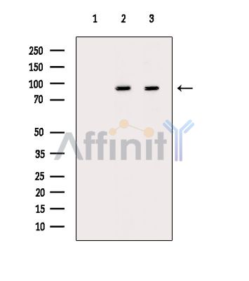 CALCOCO1 Antibody - Western blot analysis of extracts from various samples, using CALCOCO1 Antibody.
