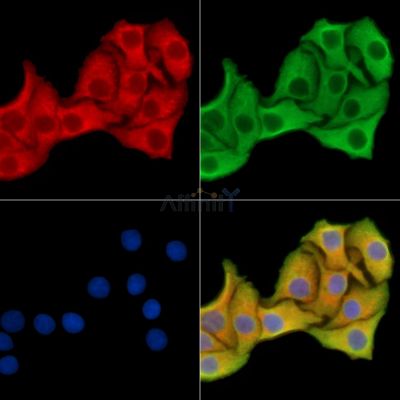 TRDMT1 Antibody - DF14641 staining Hela cells by IF/ICC.