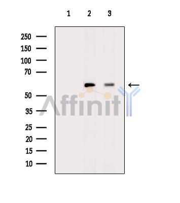 ERVK-18 Antibody - Western blot analysis of extracts from various samples, using ERVK-18 Antibody.