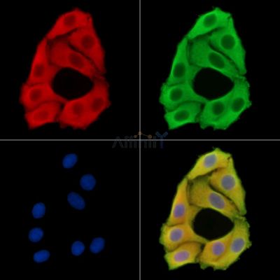 ERVK-18 Antibody - DF14642 staining Hela cells by IF/ICC.