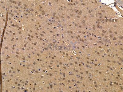 ZNF219 Antibody - DF14644 at 1/100 staining rat brain tissue by IHC-P.