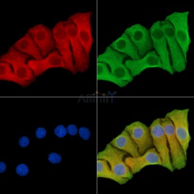 ART1 Antibody - DF14645 staining Hela cells by IF/ICC.