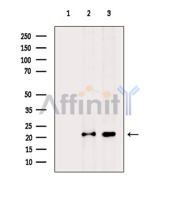 SRI Antibody - Western blot analysis of extracts from various samples, using SRI Antibody.
