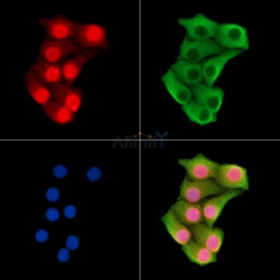 HMGN3 Antibody - DF14654 staining Hela cells by IF/ICC.