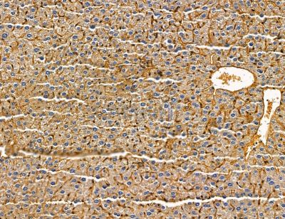 KIF13A Antibody - DF14657 at 1/100 staining mouse liver tissue by IHC-P.