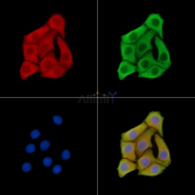 EMP3 Antibody - DF14661 staining Hela cells by IF/ICC.