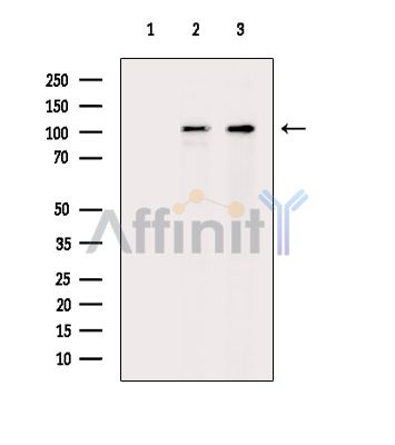 INTS5 Antibody - Western blot analysis of extracts from various samples, using INTS5 Antibody.