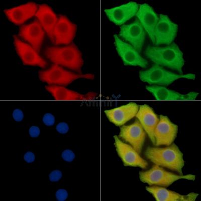 NENF Antibody - DF14667 staining Hela cells by IF/ICC.