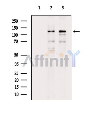 CLEC16A Antibody - Western blot analysis of extracts from various samples, using CLEC16A Antibody.