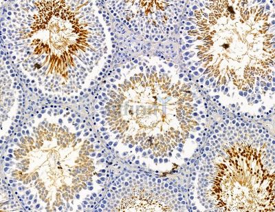 ECHDC2 Antibody - DF14678 at 1/100 staining rat testis tissue by IHC-P.