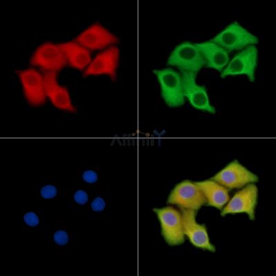 AMHR2 Antibody - DF14679 staining Hela cells by IF/ICC.