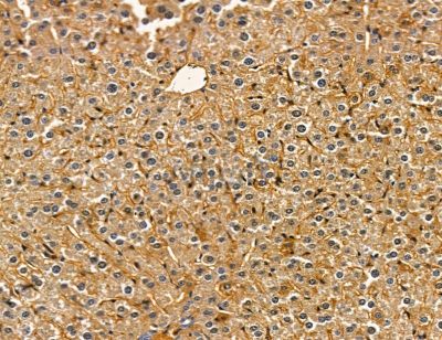 AMHR2 Antibody - DF14679 at 1/100 staining mouse liver tissue by IHC-P.