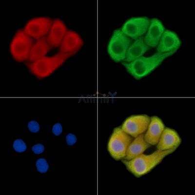 ARL1 Antibody - DF14682 staining Hela cells by IF/ICC.
