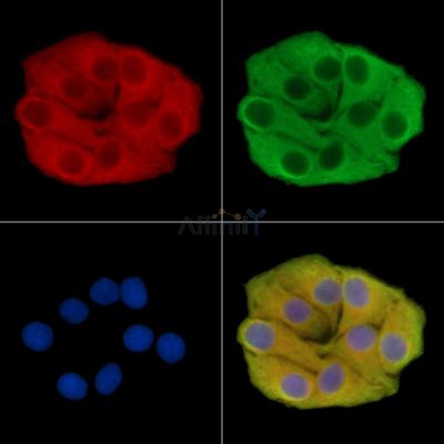 POTED Antibody - DF14684 staining Hela cells by IF/ICC.