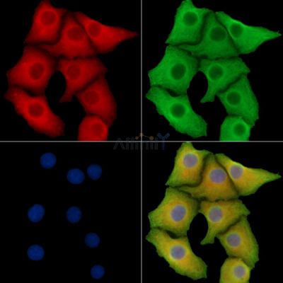 TMEM163 Antibody - DF14686 staining Hela cells by IF/ICC.