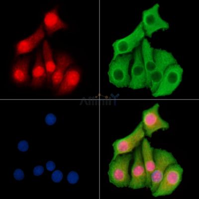 NUCKS1 Antibody - DF14692 staining Hela cells by IF/ICC.