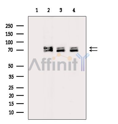 MEX3A Antibody - Western blot analysis of extracts from various samples, using MEX3A Antibody.
