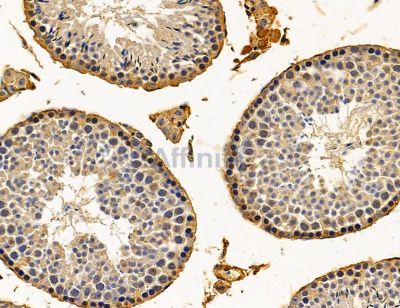 MEX3A Antibody - DF14699 at 1/100 staining mouse testis tissue by IHC-P.
