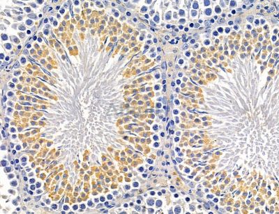 TSPAN33 Antibody - DF14701 at 1/100 staining rat colorectal tissue by IHC-P.