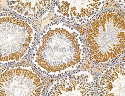 PLA2R1 Antibody - DF14705 at 1/100 staining rat testis tissue by IHC-P.
