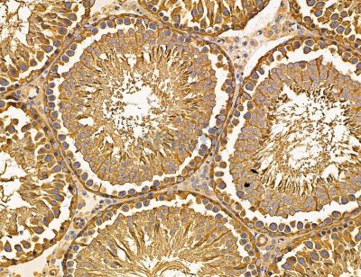 SHPRH Antibody - DF14707 at 1/100 staining rat testis tissue by IHC-P.