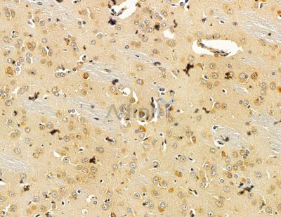 MMEL1 Antibody - DF14725 at 1/100 staining rat brain tissue by IHC-P.